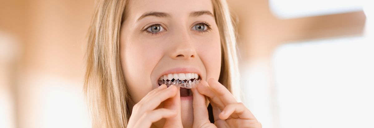 Teeth-Whitening-guide