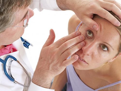 Red Dots Around Eyes: 10 Causes and Treatments