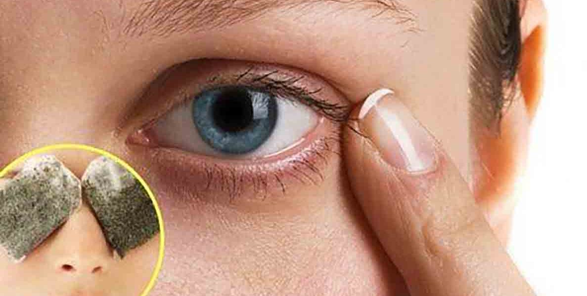 how to get rid of dark circles at home